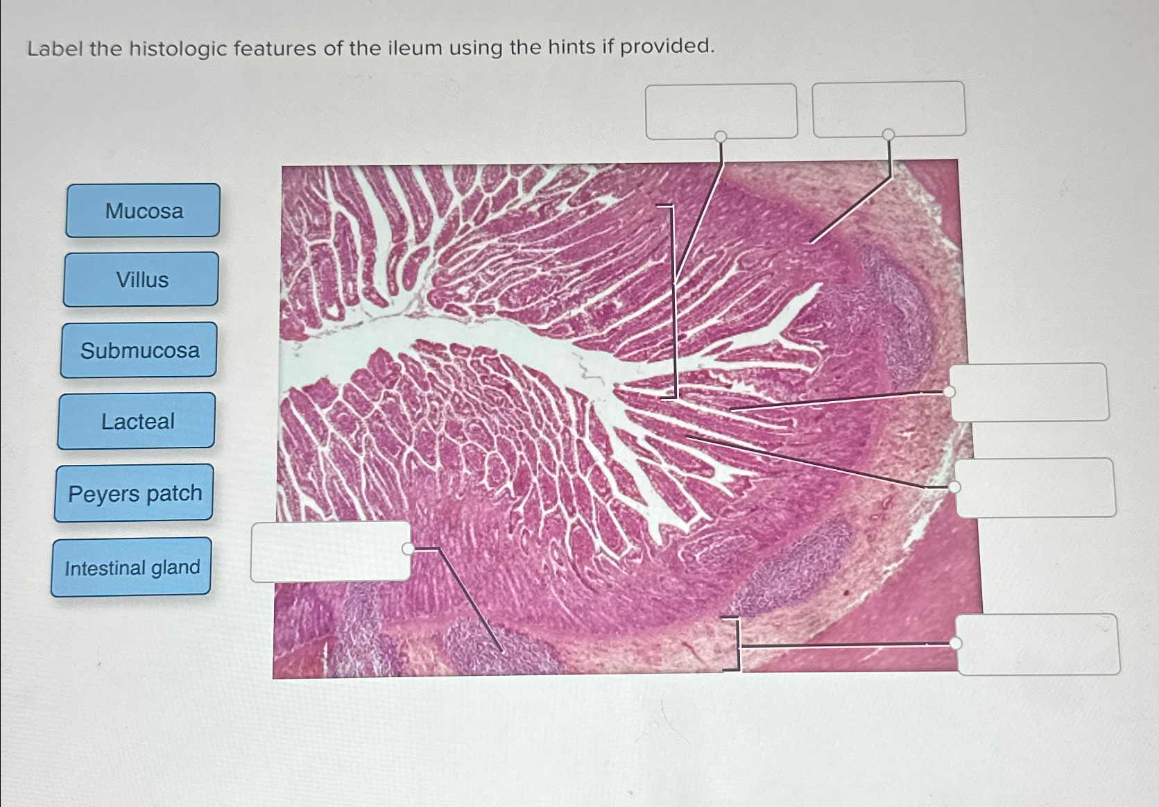 Label the histologic features of the ileum using the | Chegg.com