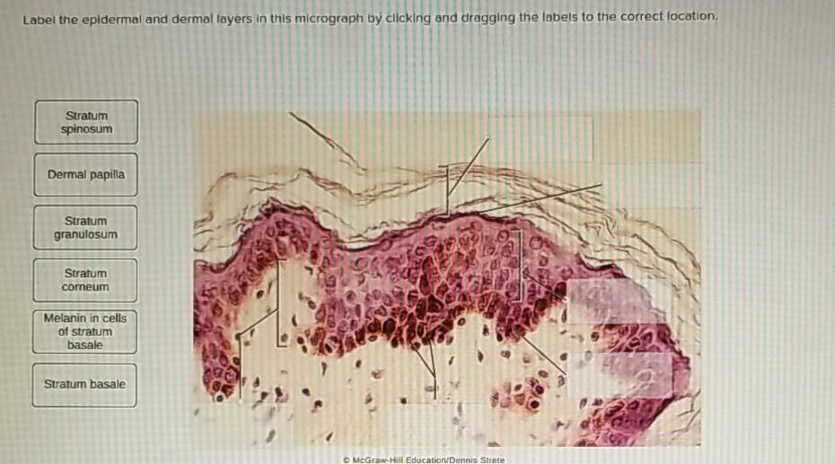 Solved Label the epidermal and dermal layers in this | Chegg.com