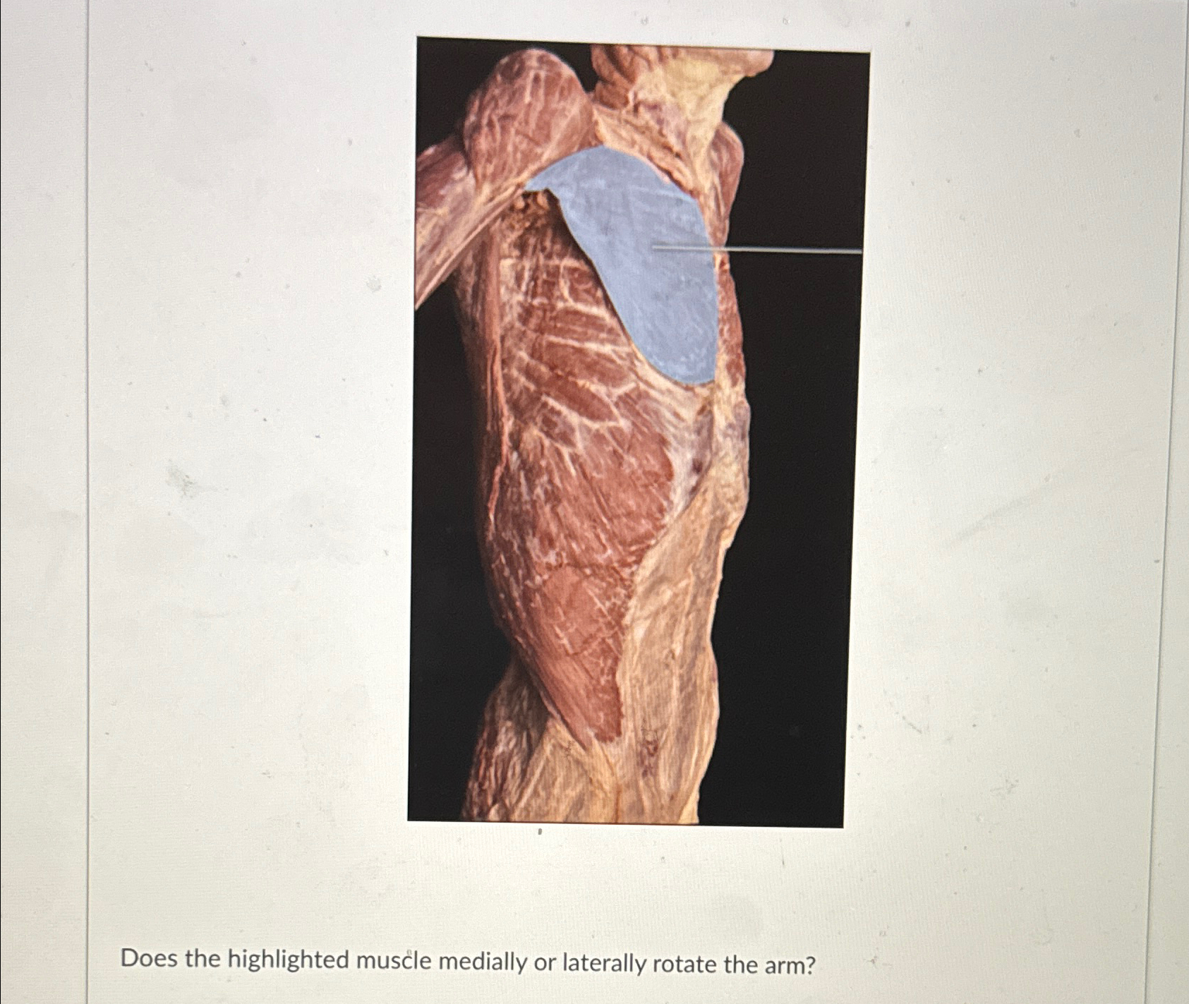 Solved Does the highlighted muscle medially or laterally | Chegg.com