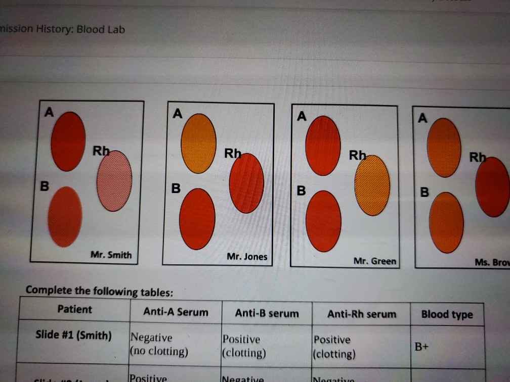 Solved Mission History: Blood Lab A А Rb Rh Rh Rb B B B B | Chegg.com