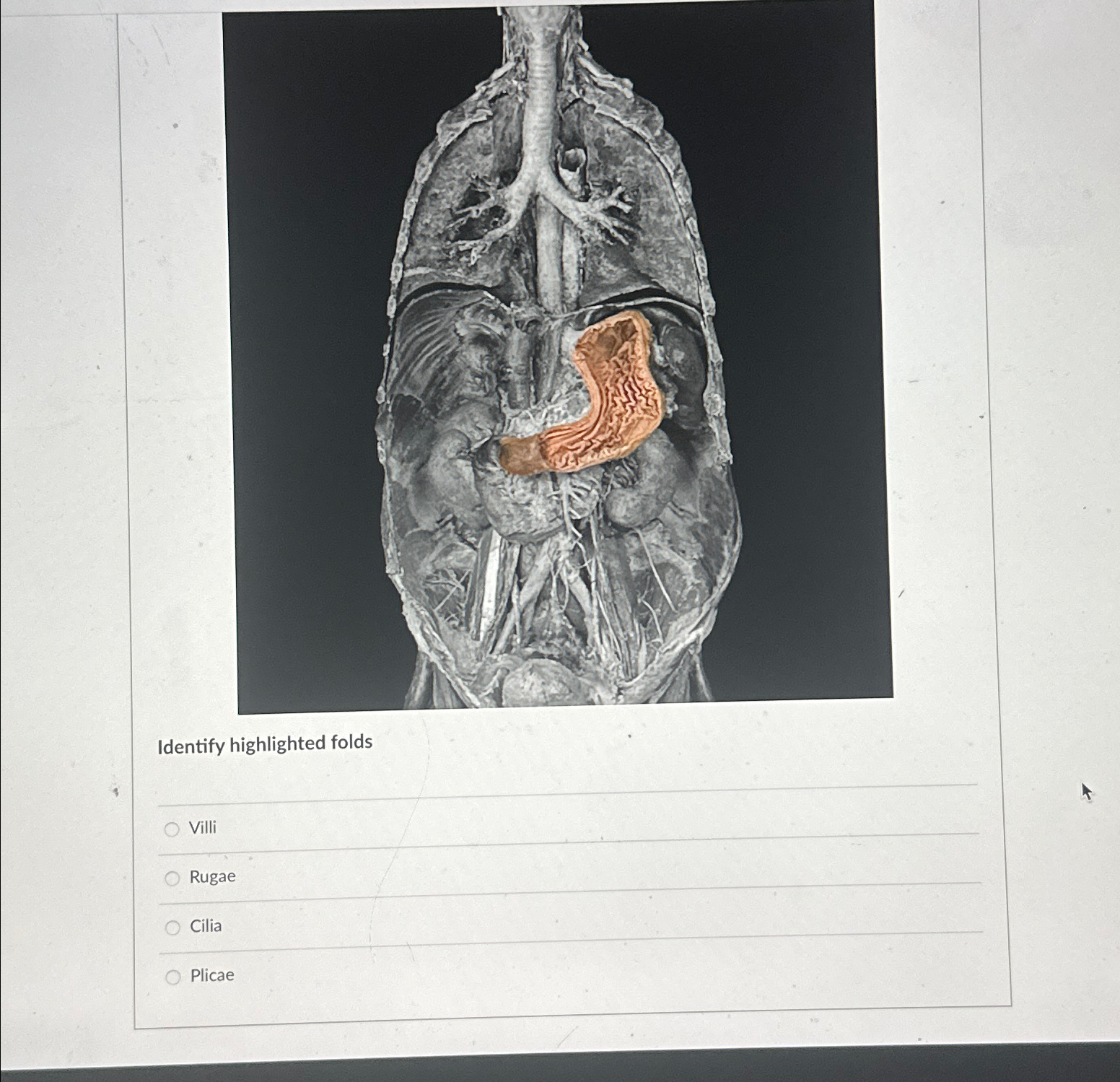 Solved Identify highlighted foldsVilliRugaeCiliaPlicae | Chegg.com