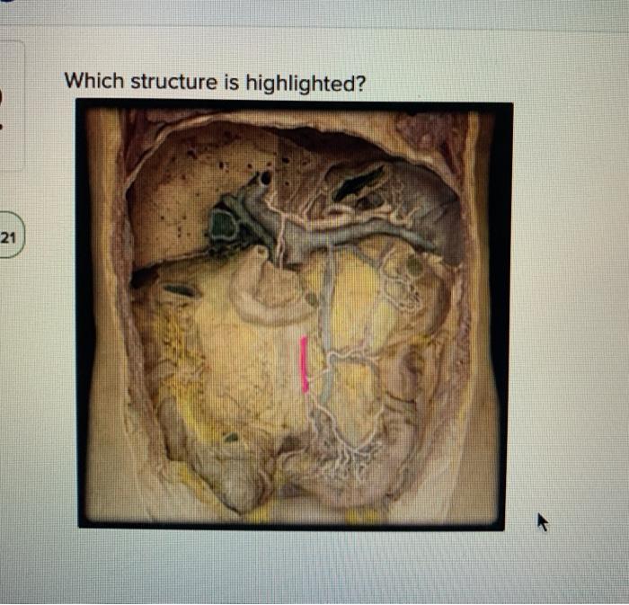 solved-which-structure-is-highlighted-21-multiple-choice-chegg