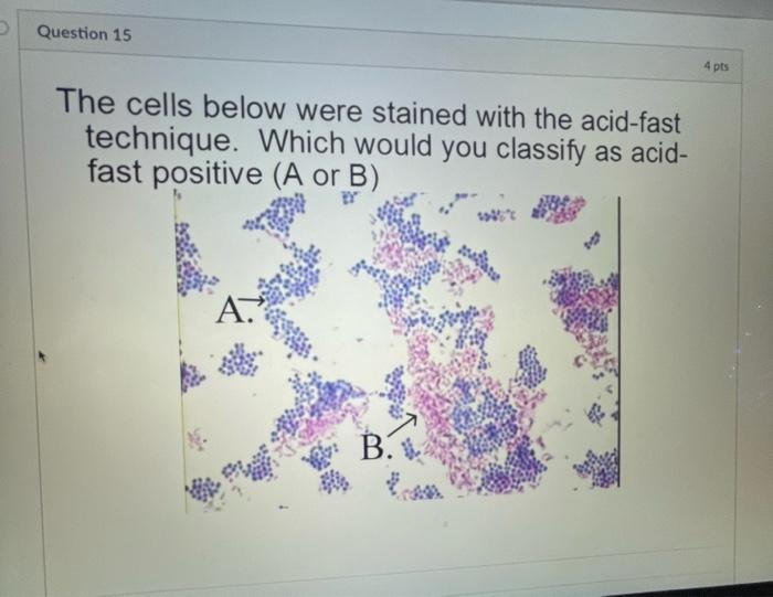 Solved The cells below were stained with the acid-fast | Chegg.com