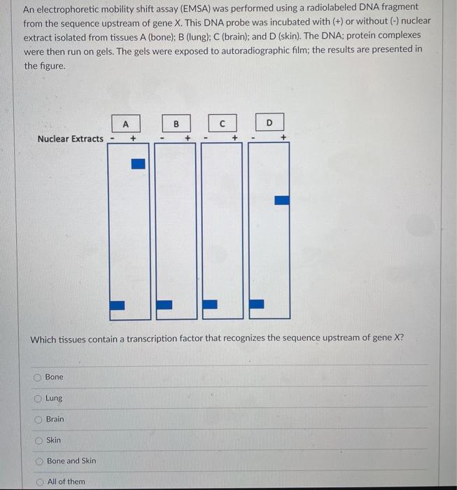Solved An electrophoretic mobility shift assay (EMSA) was | Chegg.com