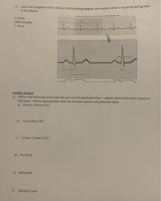 Solved 3) Label each segment of the ECG on the following | Chegg.com