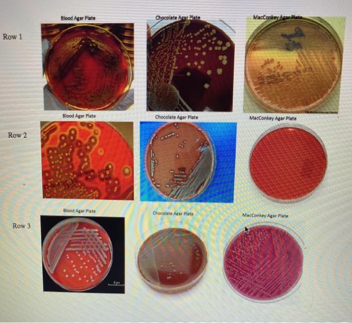 Solved Blood Agar Plate Chocolate Arar Plate MacConkey Apach
