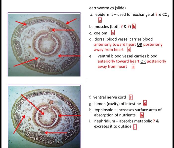 Solved earthworm cs (slide) a. epidermis - used for exchange | Chegg.com