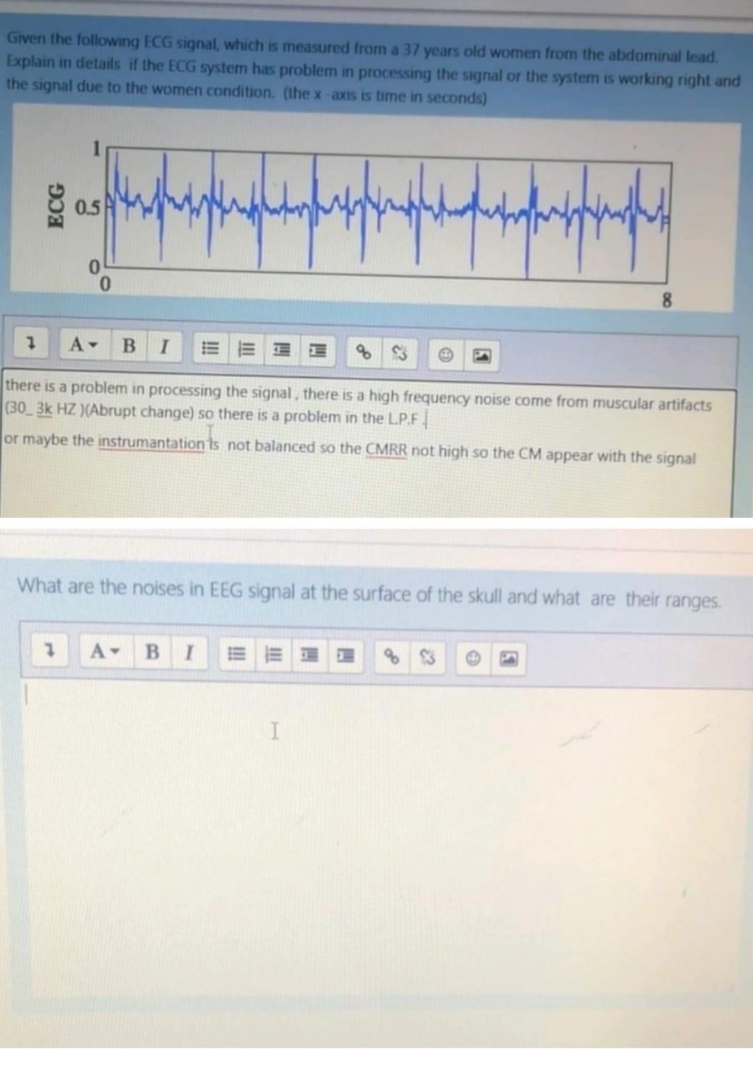 Solved Given the following ECG signal, which is measured | Chegg.com
