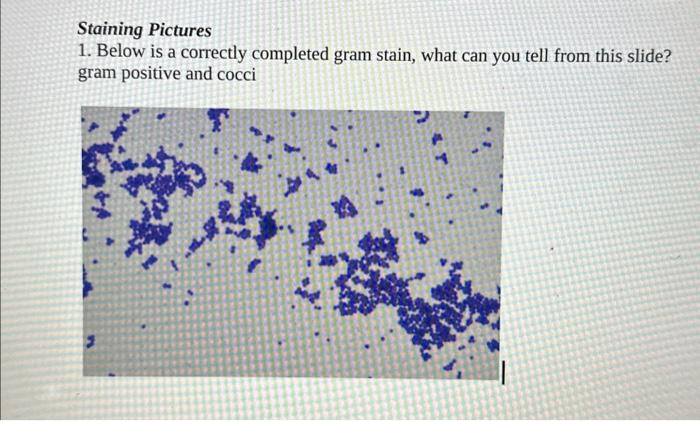 Solved Microbiology Gram Staining. What Can Be Determined | Chegg.com