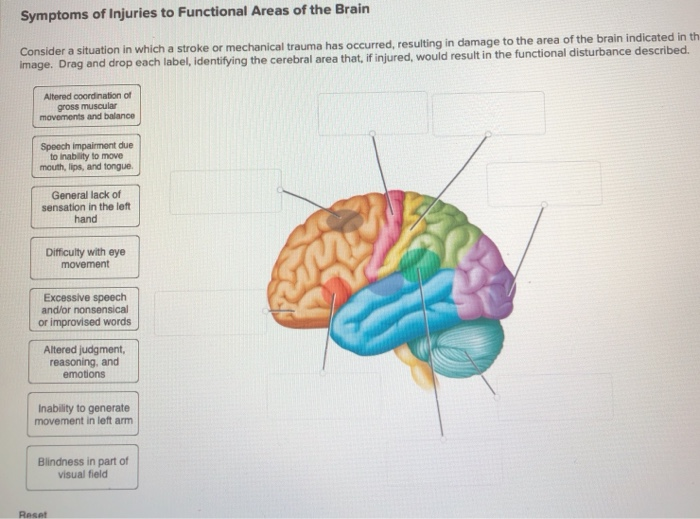 solved-symptoms-of-injuries-to-functional-areas-of-the-brain-chegg