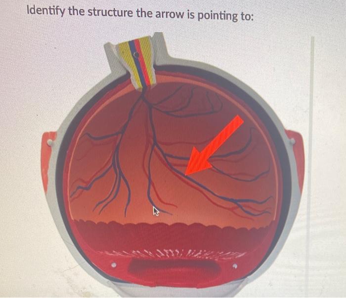 Solved Identify the structure the arrow is pointing to: | Chegg.com