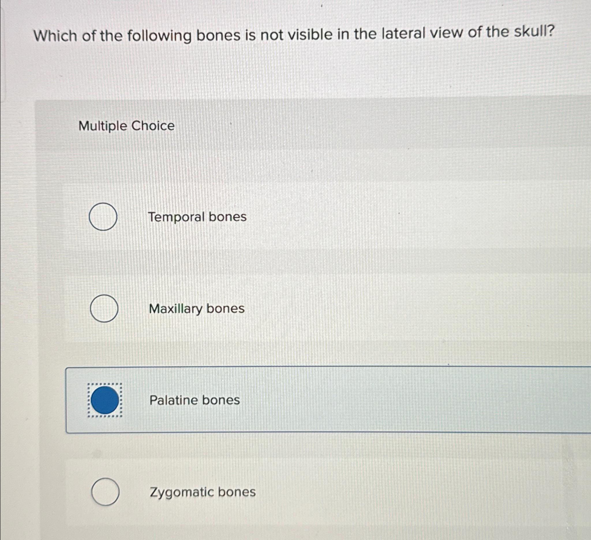 solved-which-of-the-following-bones-is-not-visible-in-the-chegg