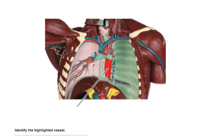 Solved Identify The Highlighted Vessel Chegg Com