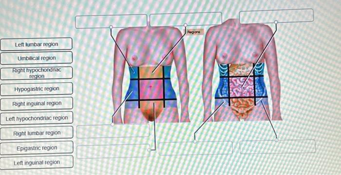 Solved What is the name of the highlighted organ? Click and | Chegg.com