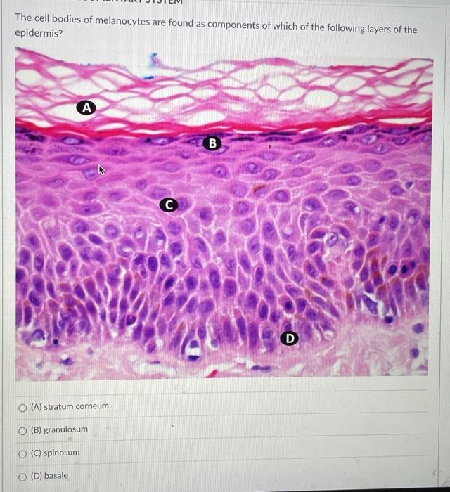 Solved The cell bodies of melanocytes are found as | Chegg.com