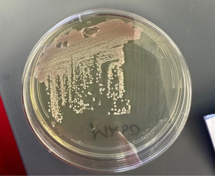 Solved Appearance of Streak Plate (mixed culture of