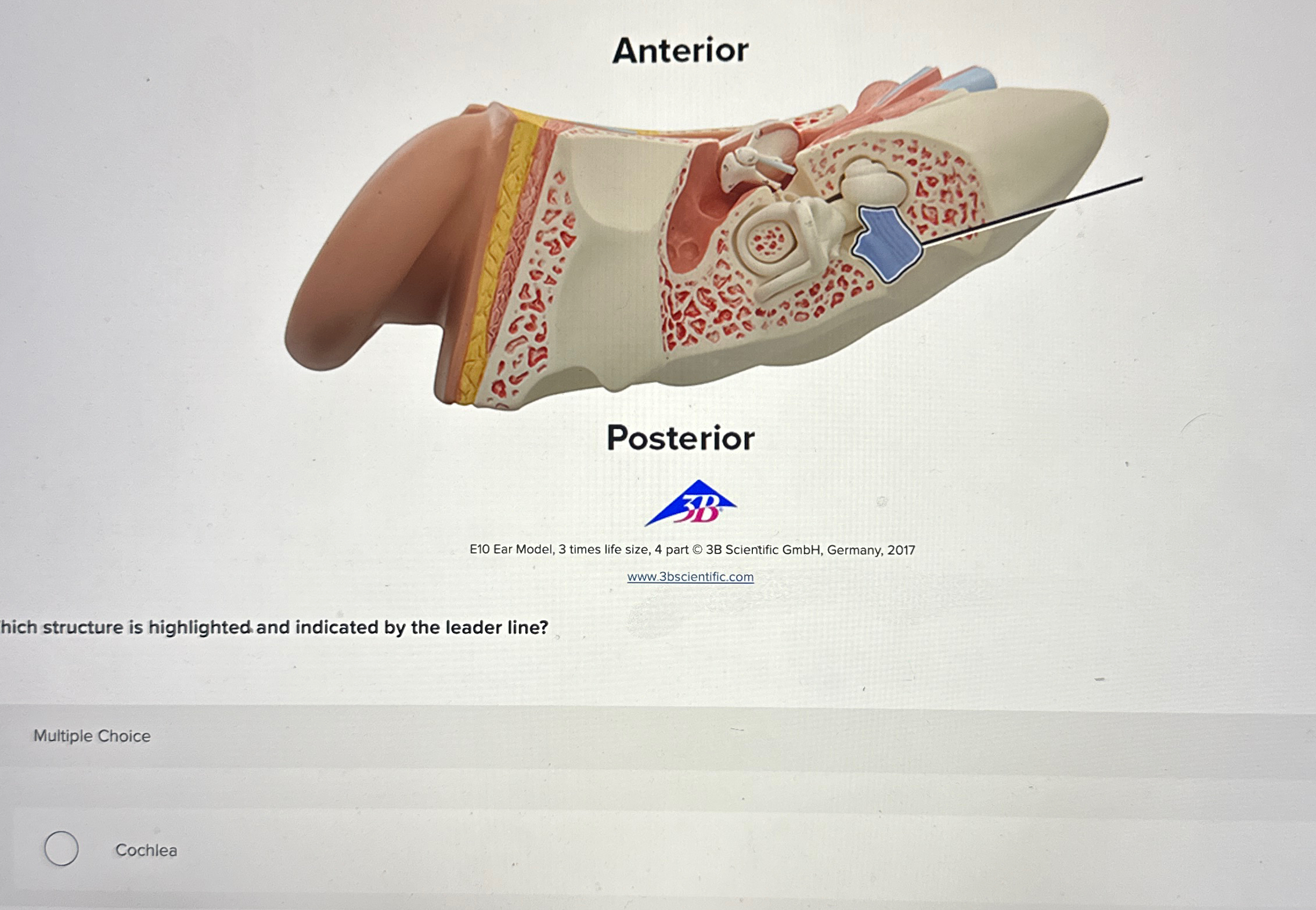 Solved E10 ﻿Ear Model, 3 ﻿times life size, 4 ﻿part (c) 3B | Chegg.com