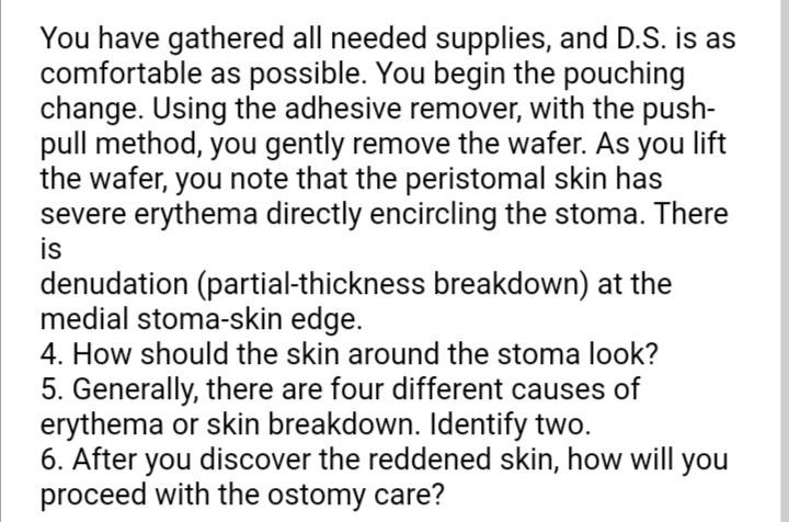 You have gathered all needed supplies, and D.S. is as comfortable as possible. You begin the pouching change. Using the adhes