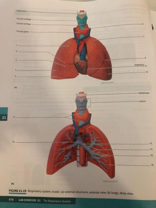 Ditki, Medical & Biological Sciences on X: Review key structures of the  Respiratory System! #respiratorysystem #grossanatomy #anatomyandphysiology  #drawanatomy #ditki #drawtolearn #drawscience #drawmedicine  #anatomytutorials #anatomyflashcards