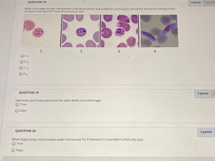 Solved 1 p QUESTION 16 The stages represented below is an | Chegg.com