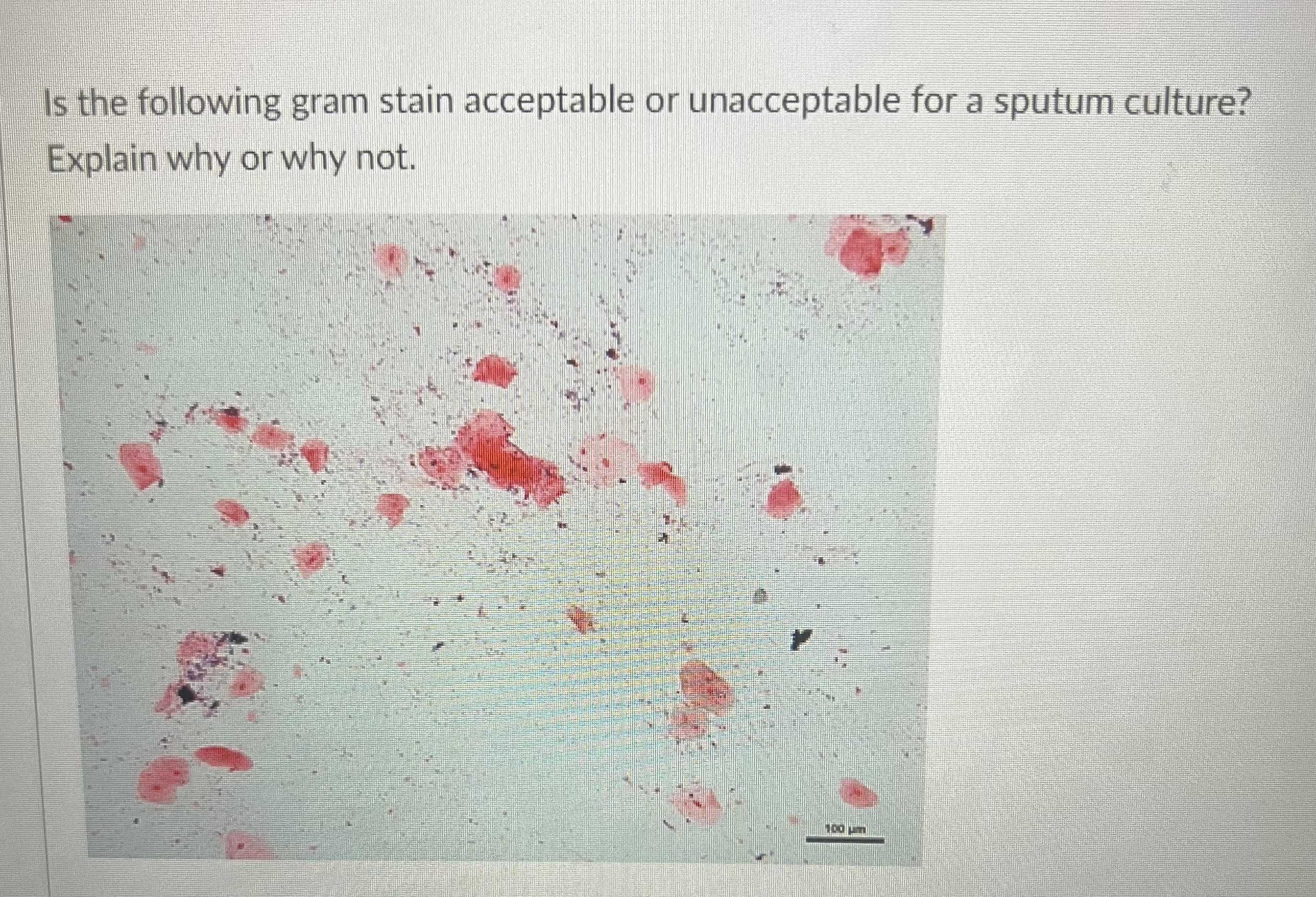 Solved Is the following gram stain acceptable or | Chegg.com