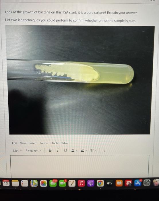 Solved Look at the growth of bacteria on this TSA slant, it