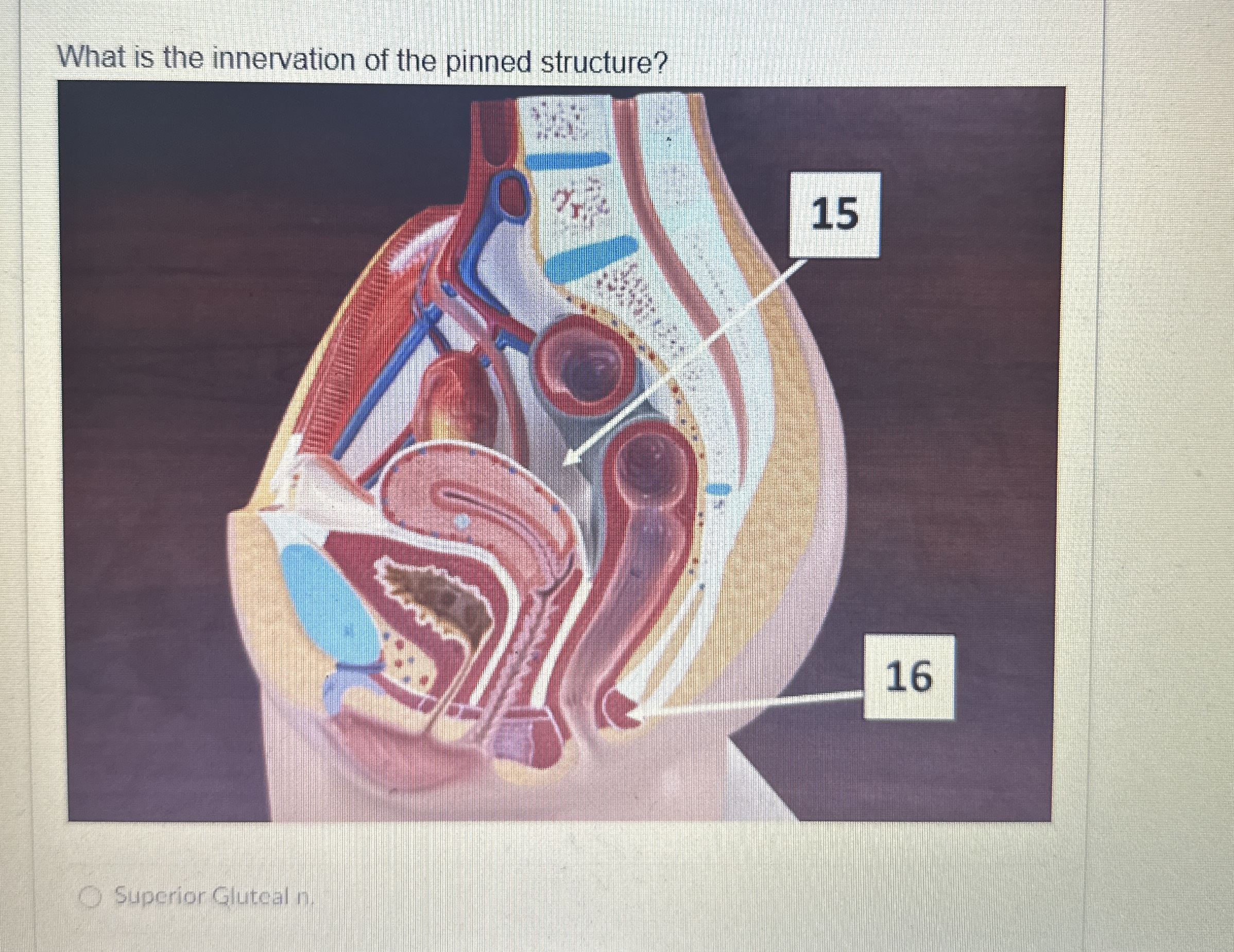 Solved What is the innervation of the pinned | Chegg.com