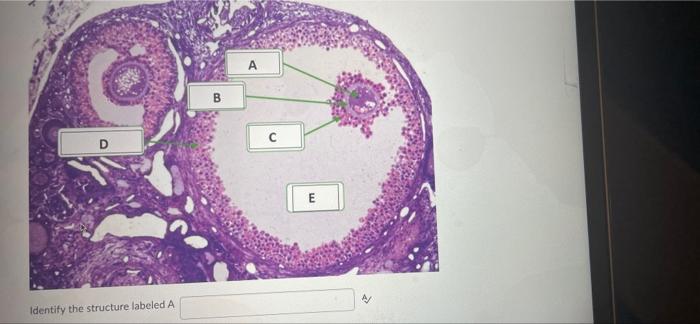 Solved A B с E Identify the structure labeled A | Chegg.com