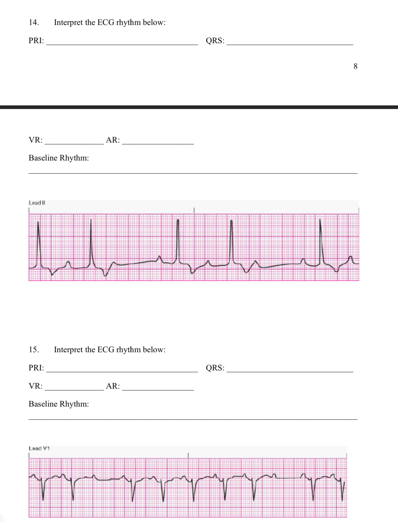 Solved Interpret the ECG rhythm | Chegg.com | Chegg.com