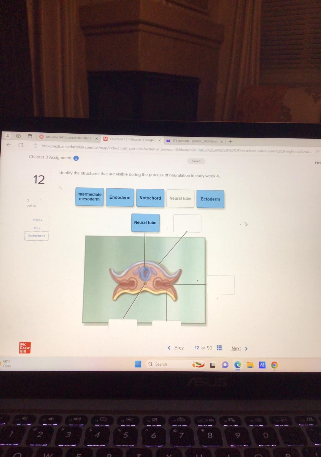 Solved 12 ﻿Identify the structures that are visible during | Chegg.com