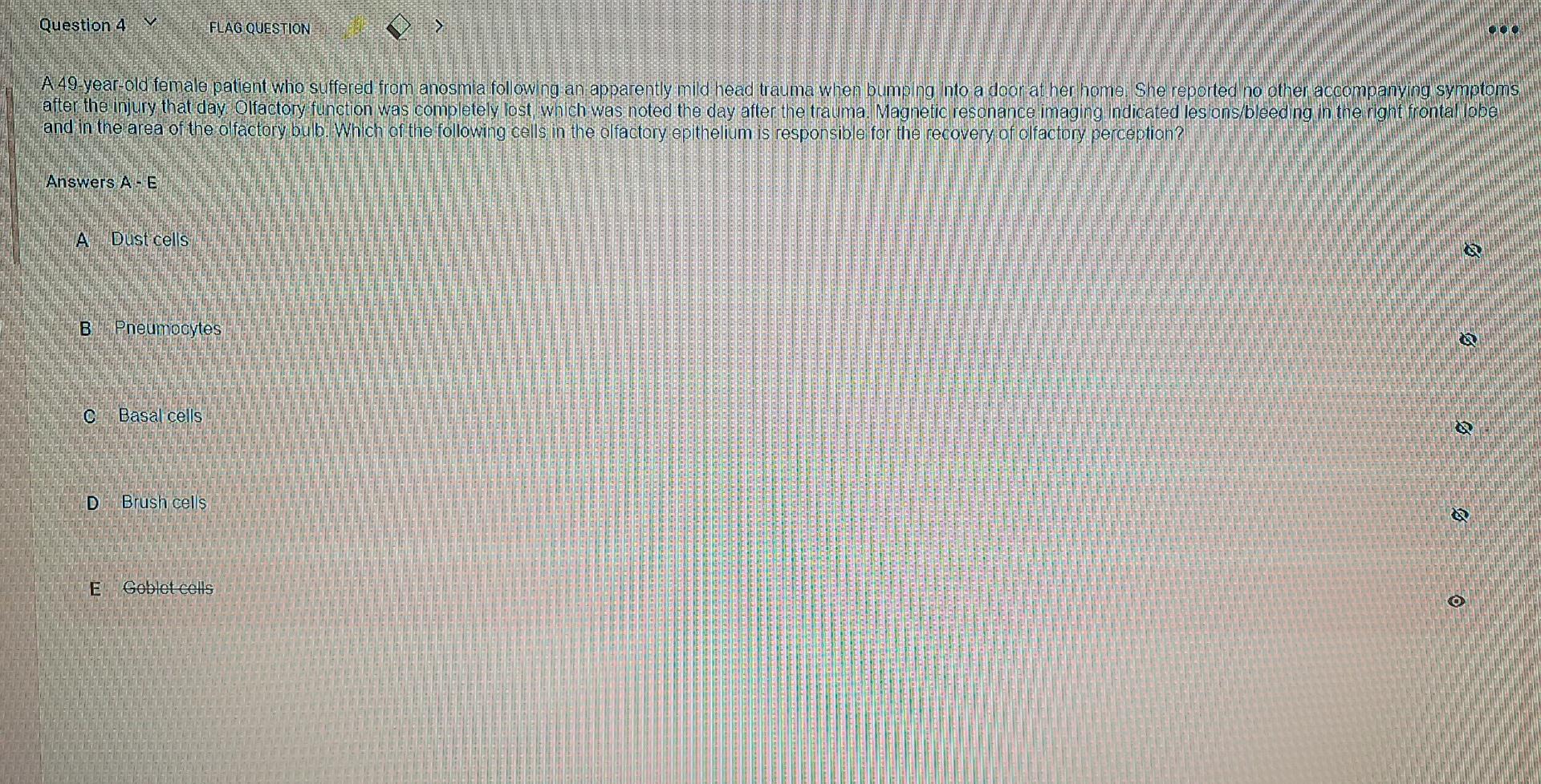 Solved Question 4 V FLAG QUESTION CO A 49-year-old female | Chegg.com