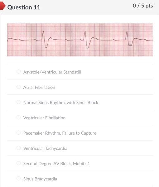 Solved Question 2 0/5 pts Asystole/Ventricular Standstill