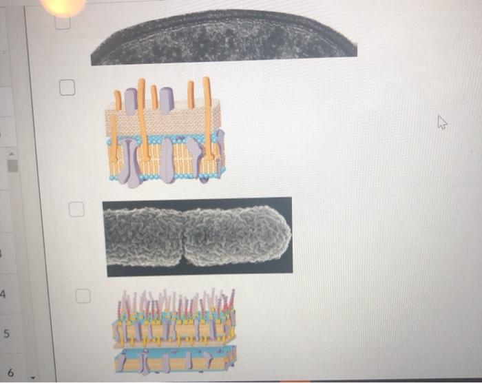 Solved Which of the following images are of gram negative | Chegg.com