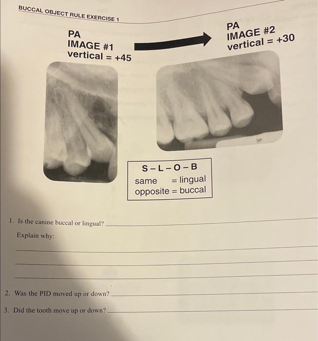 Solved BUCCAL OBJECT RULE EXERCISE 1 PA IMAGE 2 vertical =