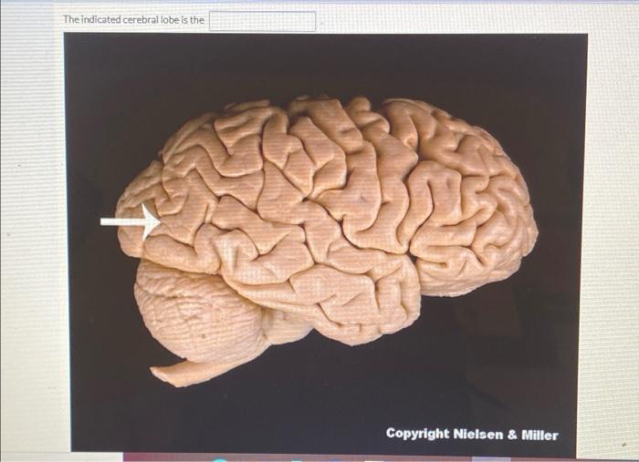 Solved The indicated structure is the herrelsen er The | Chegg.com