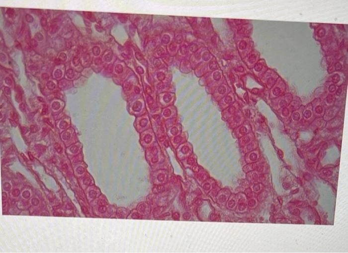 Solved what is the name of this tissue ? | Chegg.com