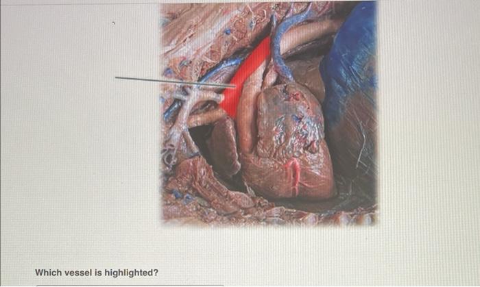 Which vessel is highlighted?