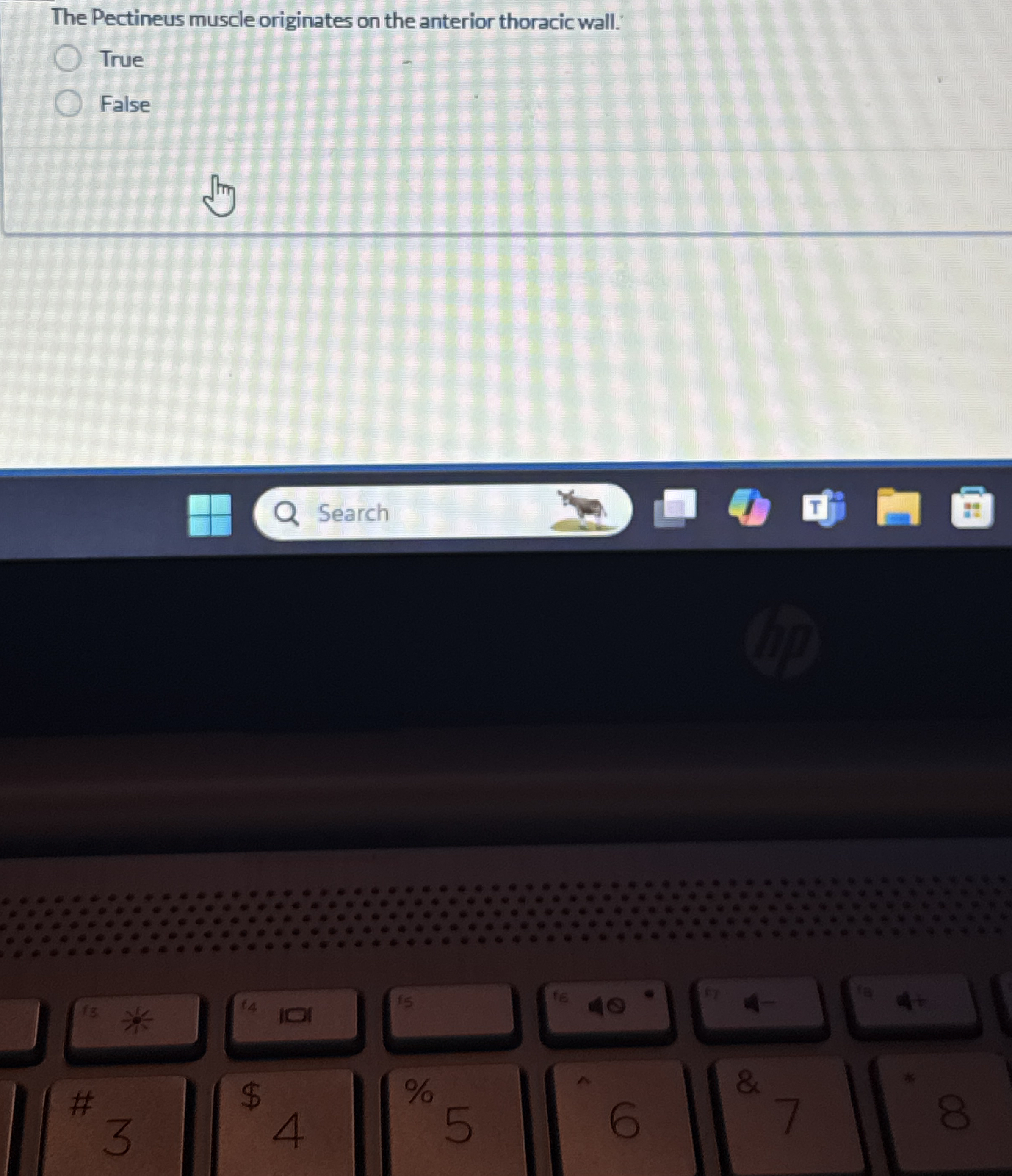 Solved The Pectineus muscle originates on the anterior