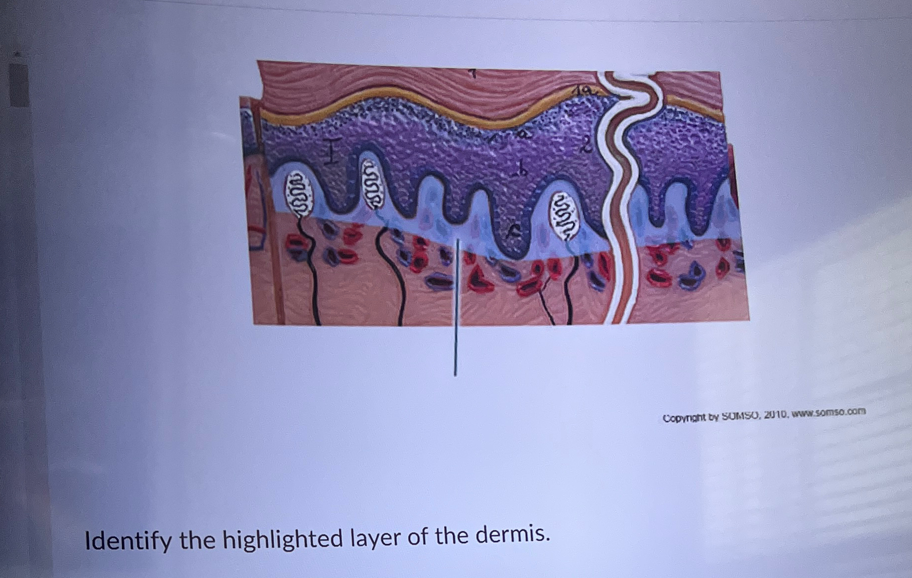 Solved Identify The Highlighted Layer Of The Dermis. 