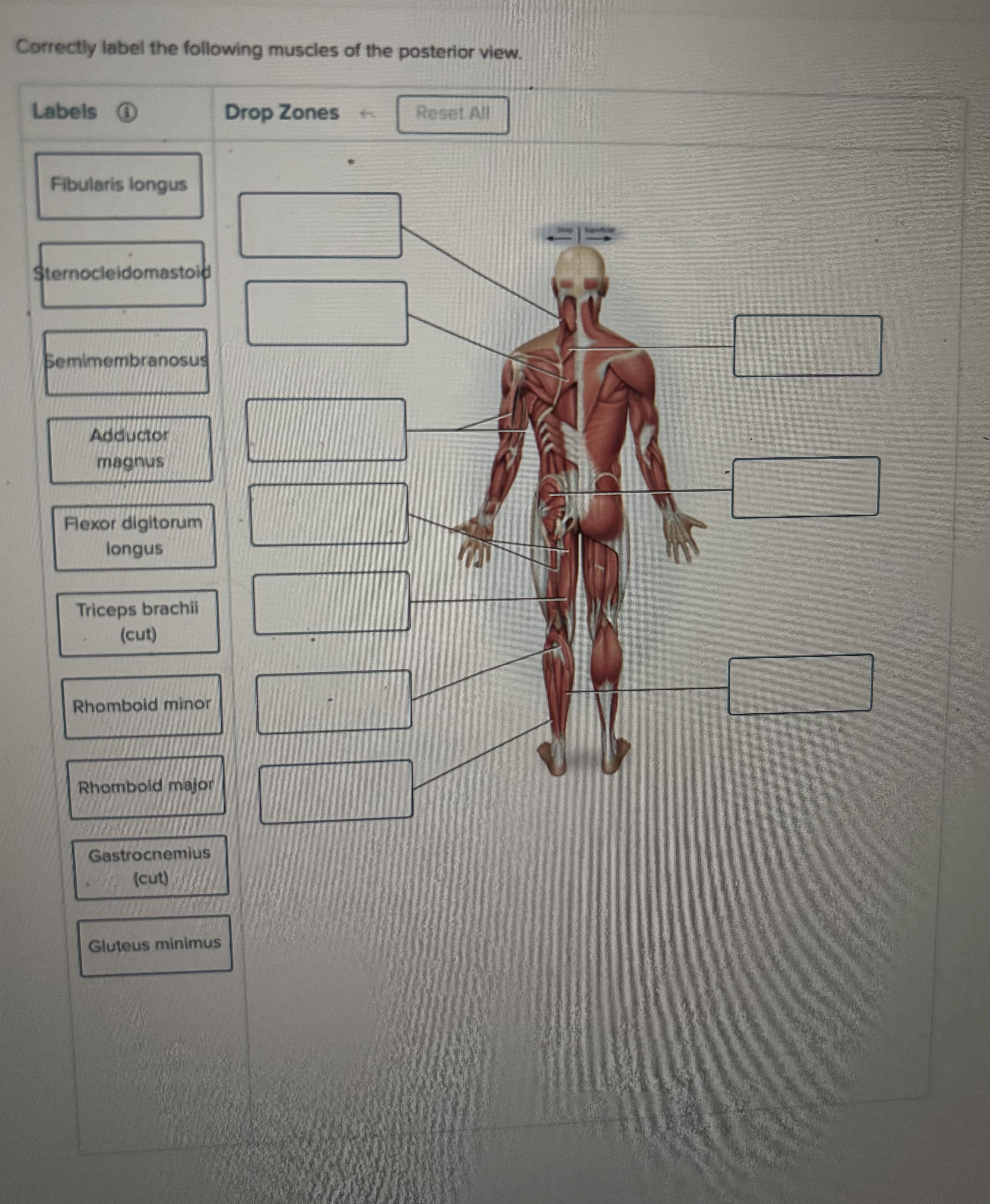 Solved Correctly label the following muscles of the | Chegg.com