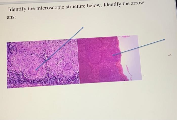 Solved Identify the microscopic structure below, Identify | Chegg.com