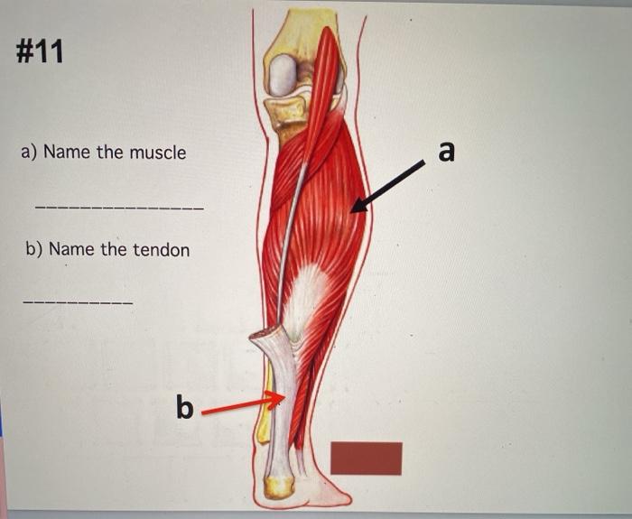 Solved #11 a) Name the muscle a b) Name the tendon b- | Chegg.com