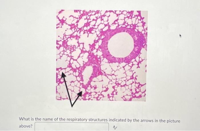 Solved What is the name of the respiratory structures | Chegg.com