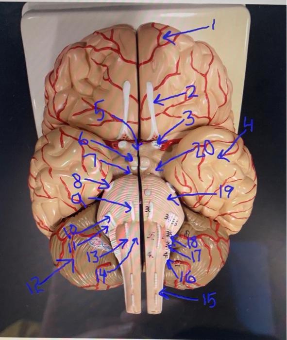 Solved [ Choose] frontal lobe trigeminal nerve (CN5) vagus | Chegg.com