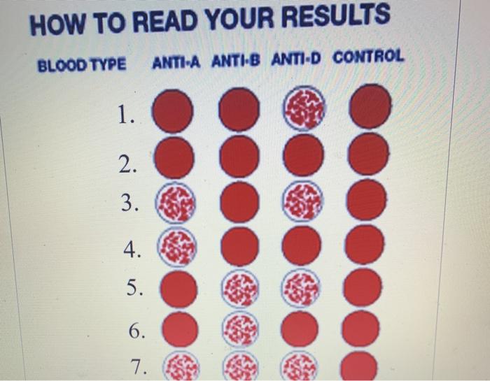 Solved HOW TO READ YOUR RESULTS BLOOD TYPE ANTI-A ANTI-B | Chegg.com