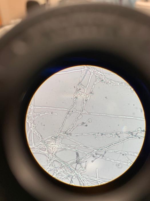 Solved microscopic mold sampleI have included photos taken | Chegg.com