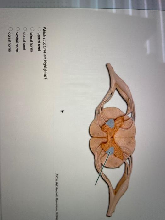 Solved LTC54. Hal Head with Mum 3 or Which structures are