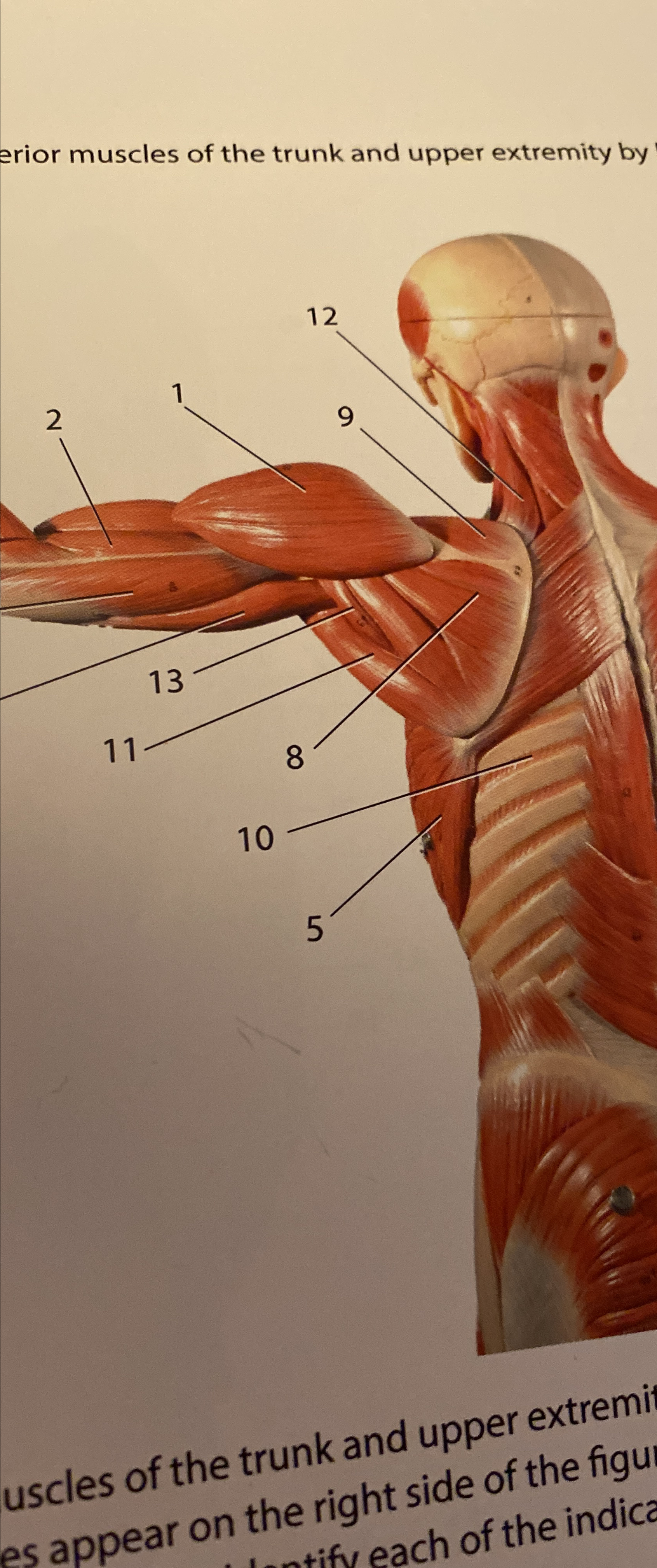 erior muscles of the trunk and upper extremity | Chegg.com