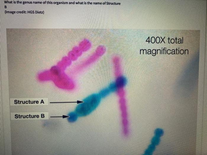 Solved Identify The Organism Pictured Above (genus Name And | Chegg.com