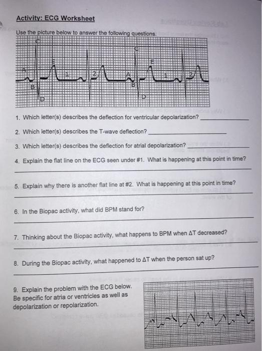 Solved Activity: ECG Worksheet Use The Picture Below To | Chegg.com